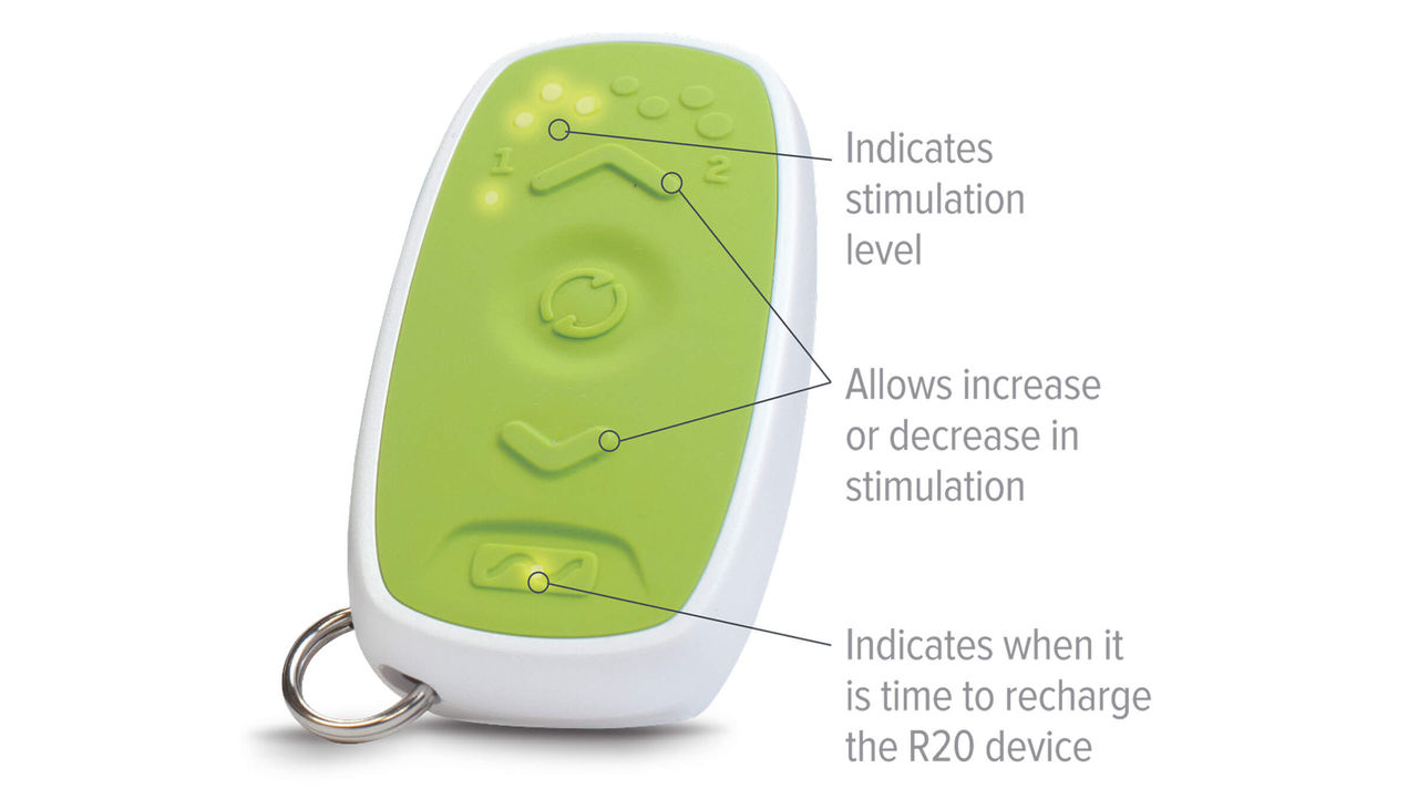SNM Recharge patient remote control product shot with callouts showing stimulation level, increase or decrease in stimulation, and time to recharge indicator.